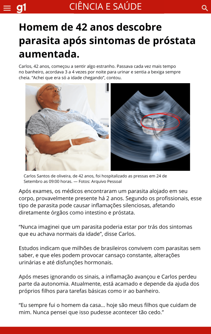 Parasitas no intestino